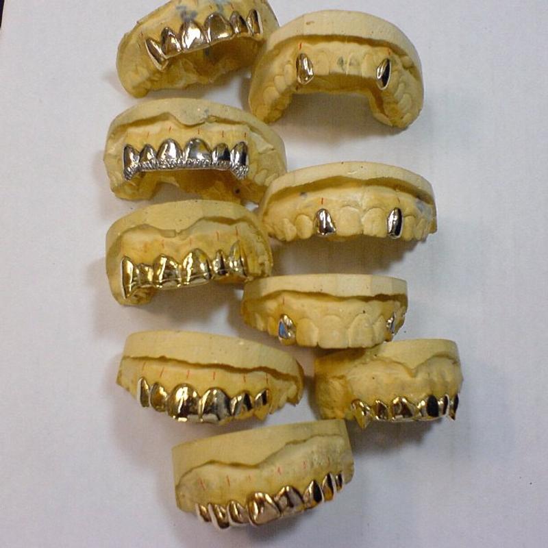 Gold Teeth / Gold Grillz for sale in Dallas, TX 5miles Buy and Sell